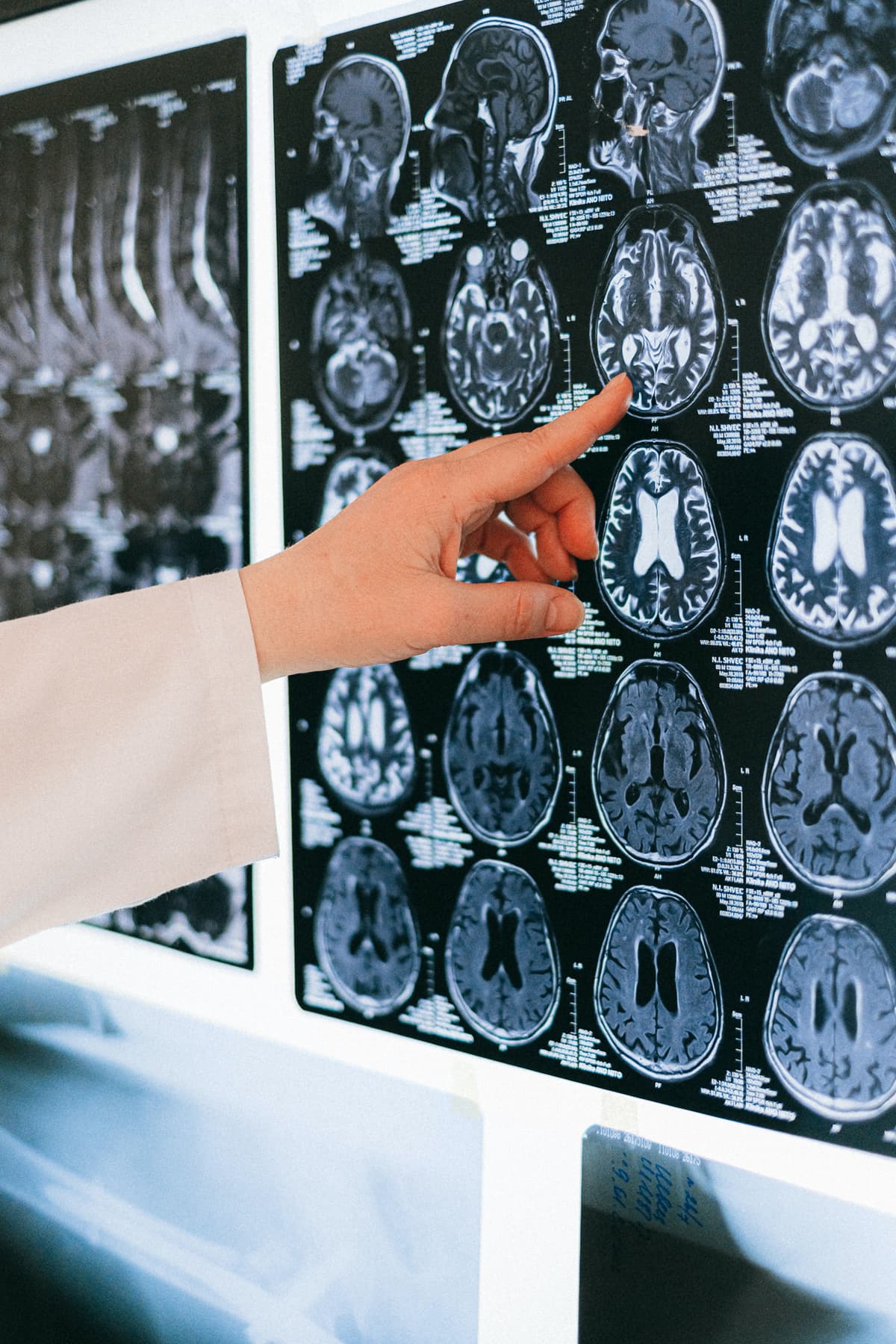 Radiologist reviewing a brain MRI at Sutlej Diagnostics